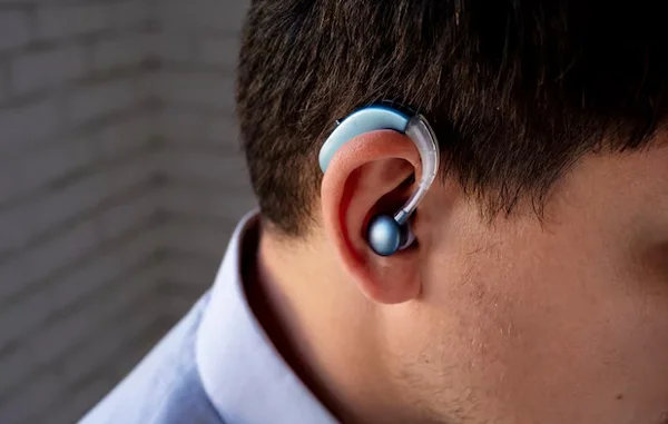 Cochlear Implant
